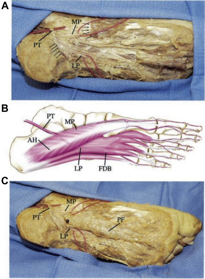 Fig 4