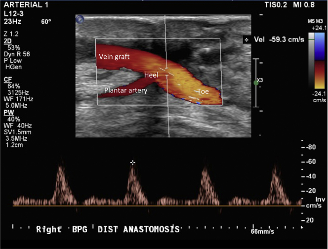 Fig 3