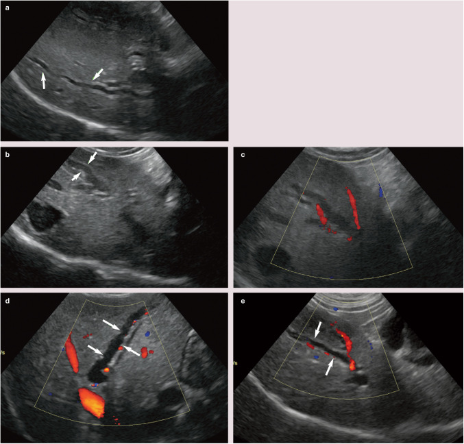 Figure 14