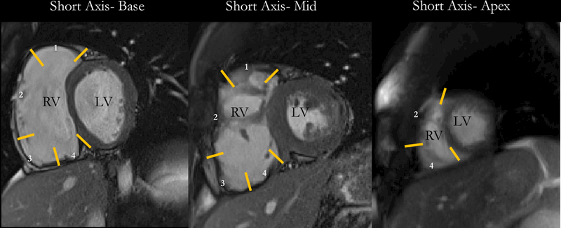 Figure 1-