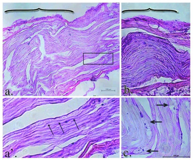 Figure 13. 