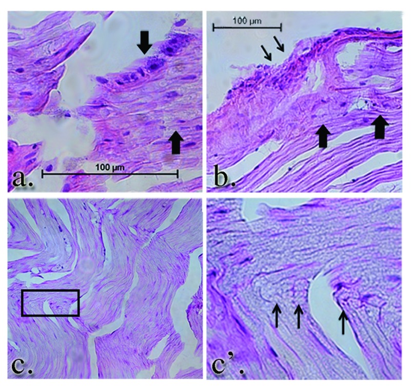 Figure 14. 