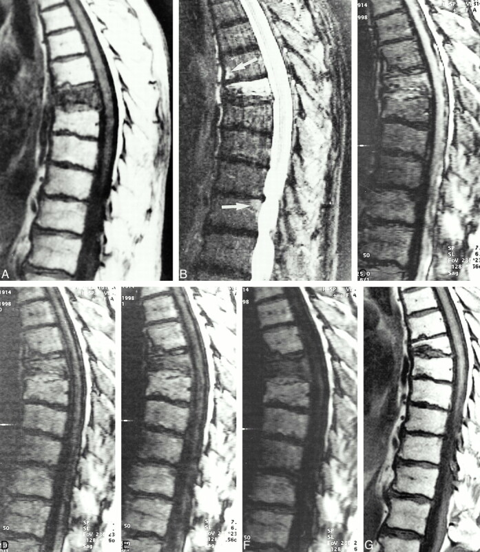 fig 2.