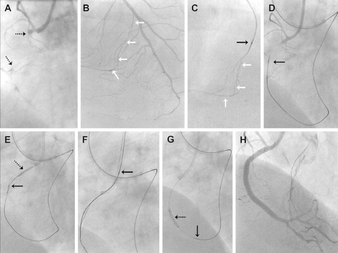 Fig. 1