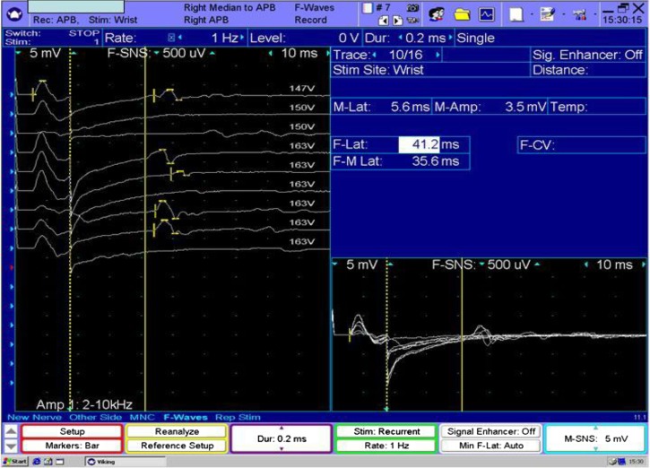 Figure 2