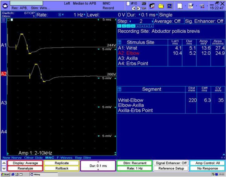 Figure 1