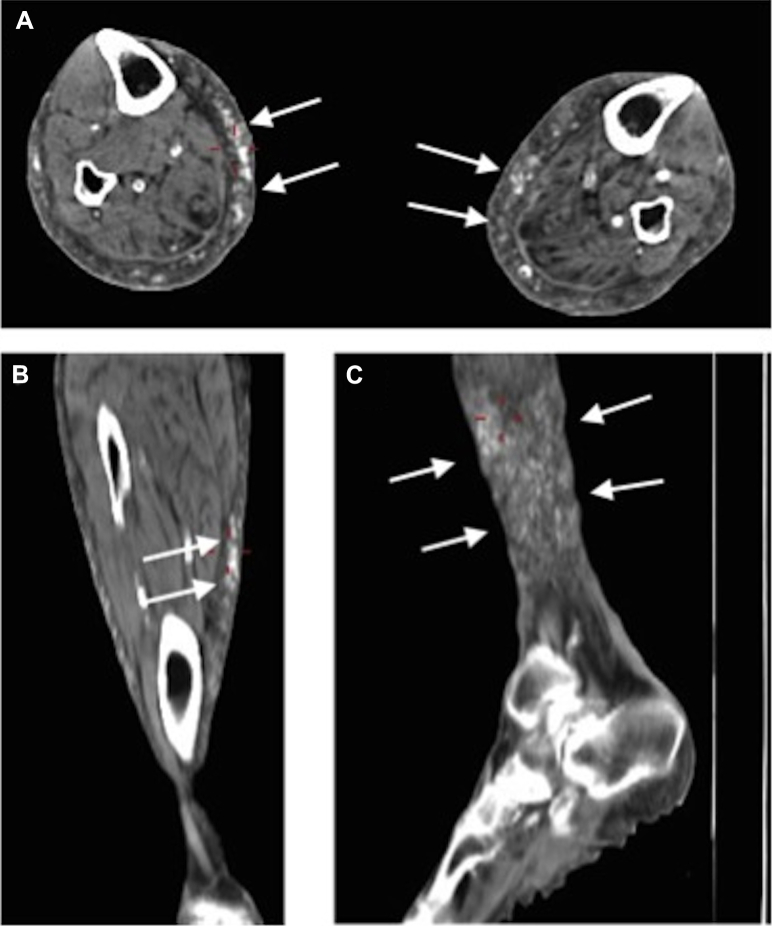 Fig. 2