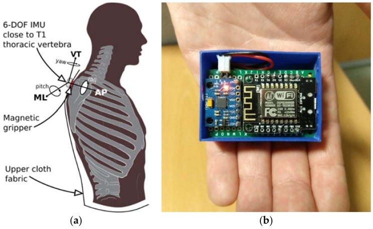 Figure 14