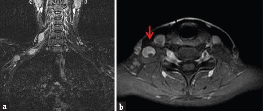 Figure 16