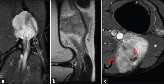 Figure 18