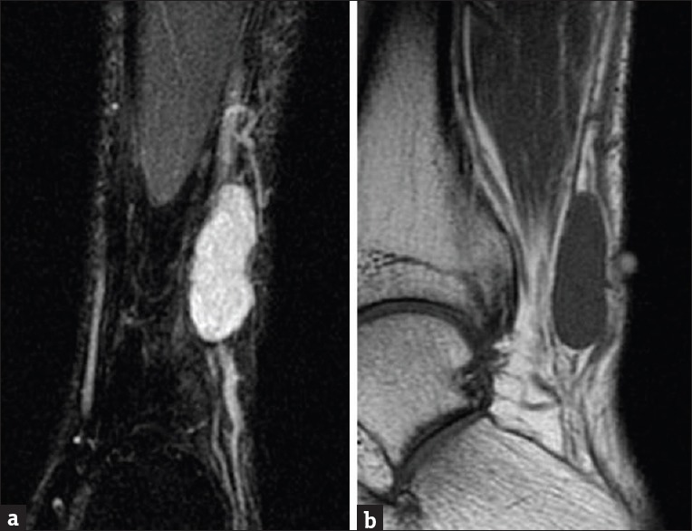 Figure 19