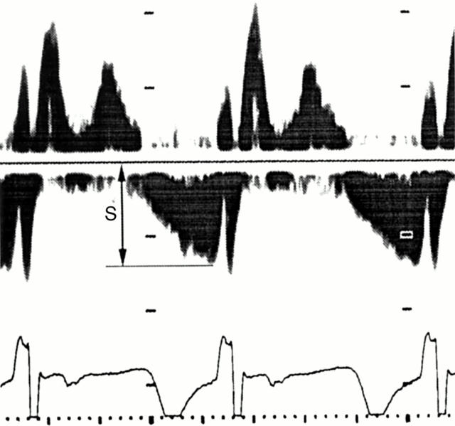 Figure 2  