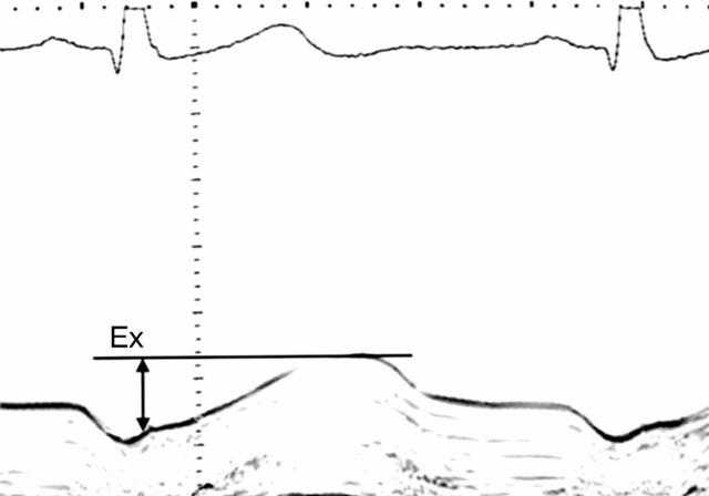 Figure 1  