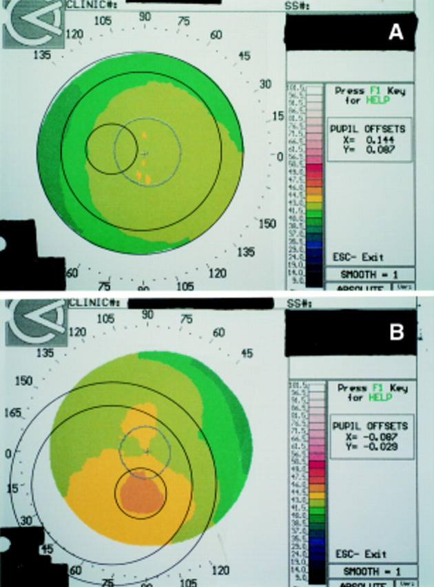 Figure 2  