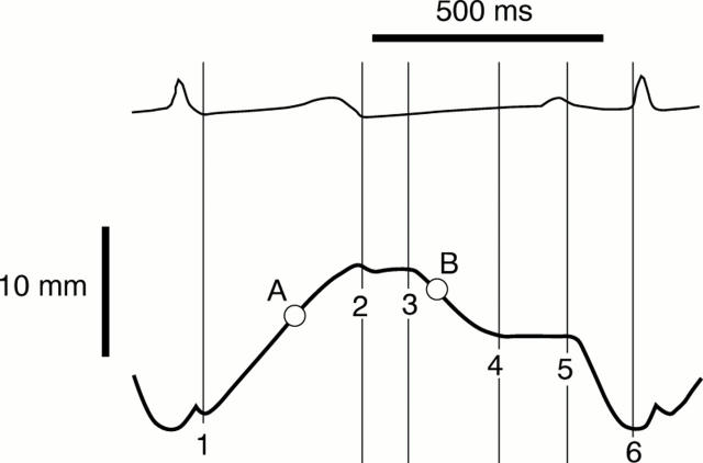 Figure 1  