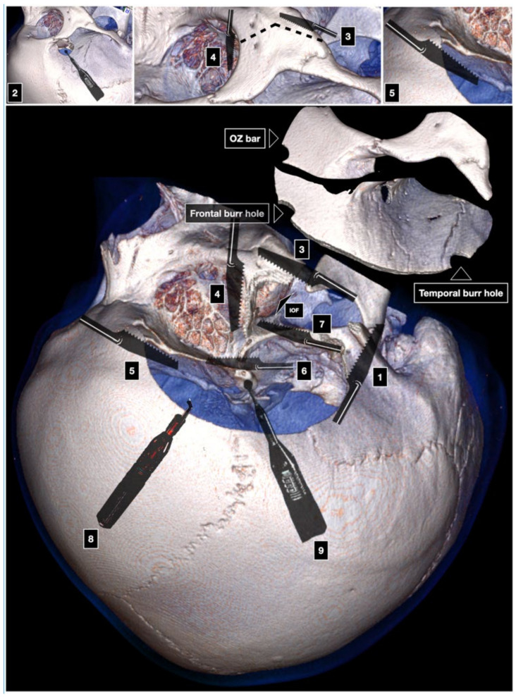 Figure 4