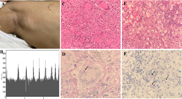 Figure 3