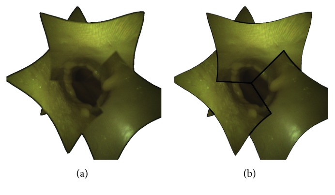 Figure 11