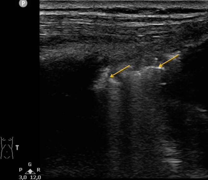 graphic file with name 117_2020_747_Fig6_HTML.jpg