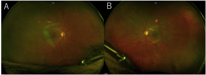 Fig. 4