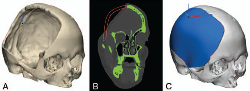 FIGURE 1