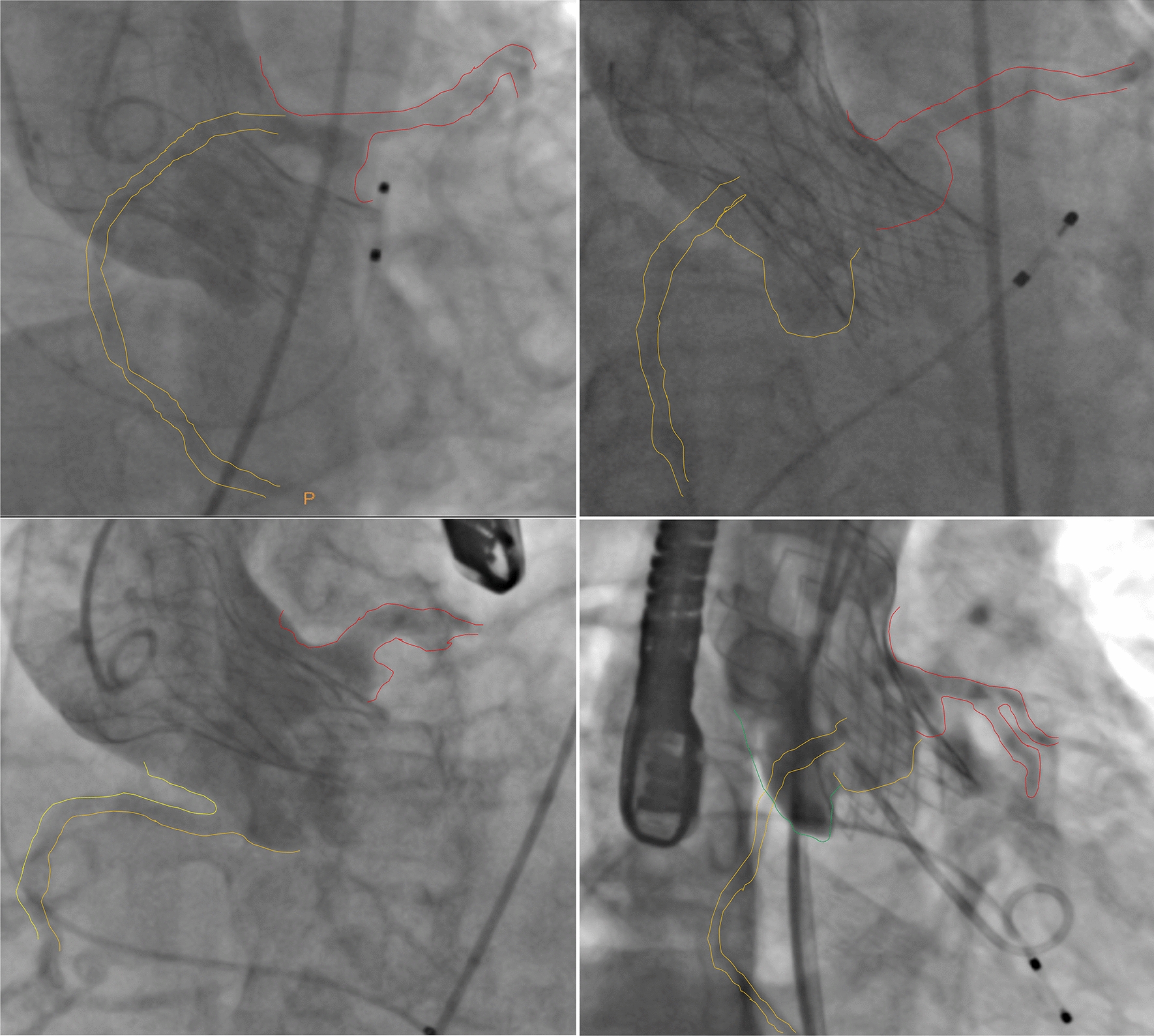 Fig. 1