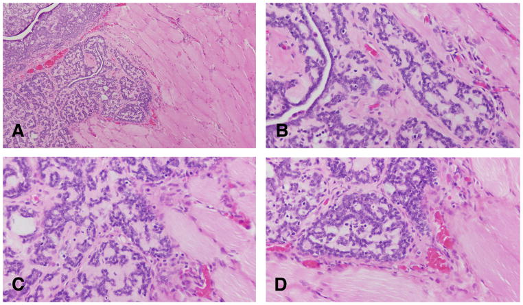 Figure 18