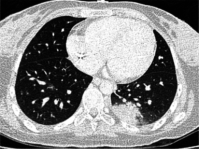 Fig 10