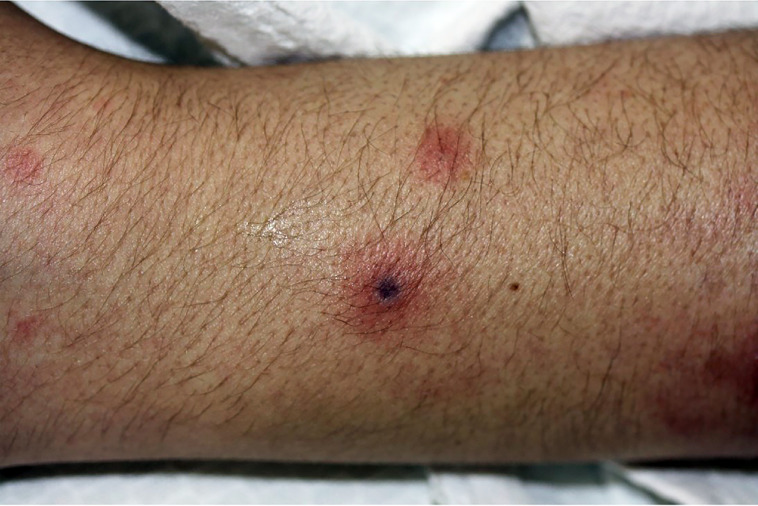 Fig 5