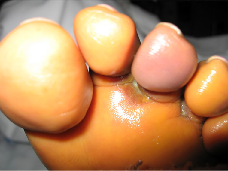 Fig 6