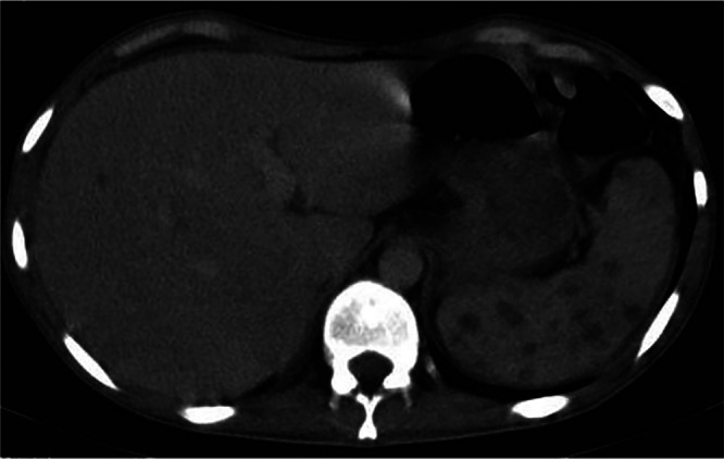 Fig 13