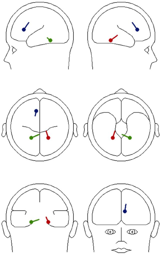 Fig. 2