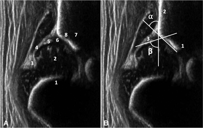 Fig. 1A