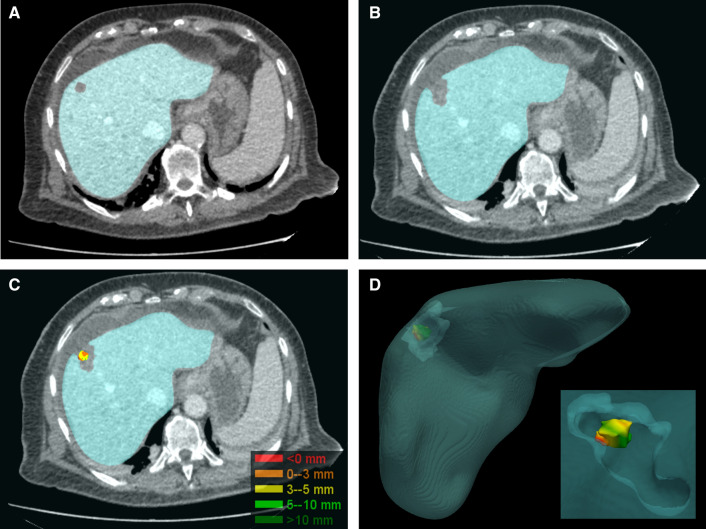 Fig. 2.