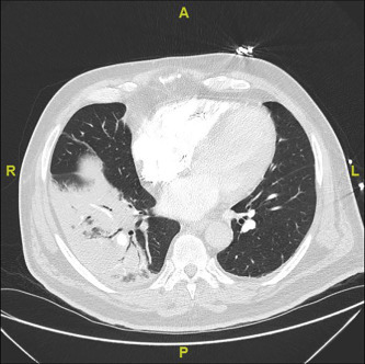 Fig. 2