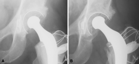 Fig. 1A–B