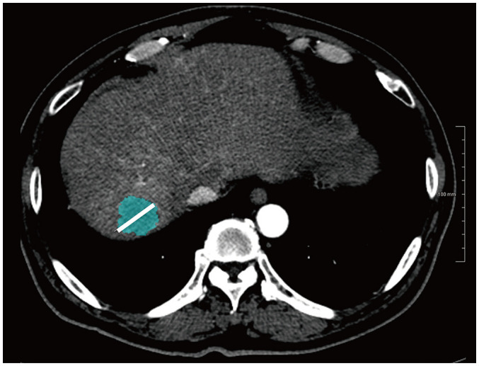 Fig. 2