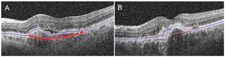 Fig. 3