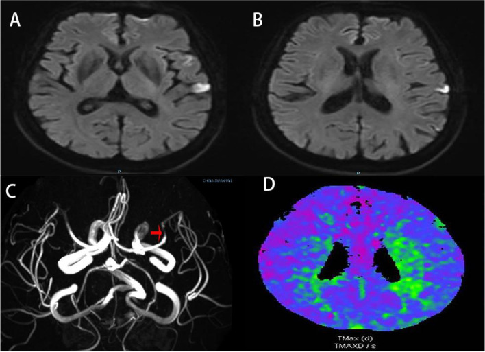 Fig. 1