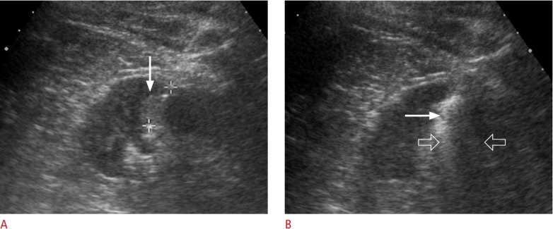 Fig. 14.