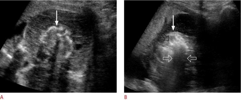 Fig. 15.