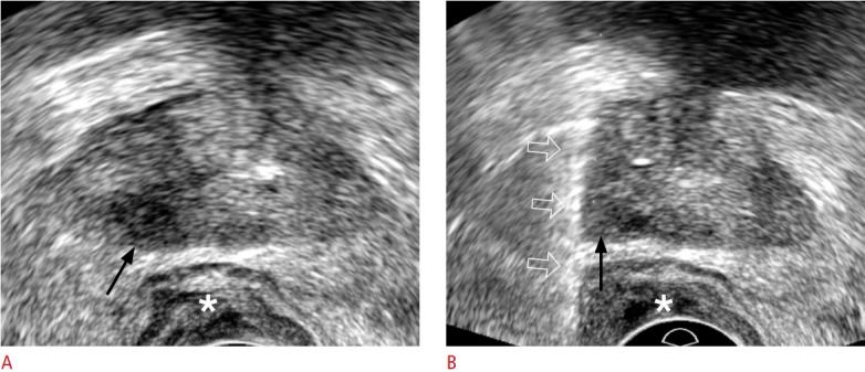 Fig. 13.