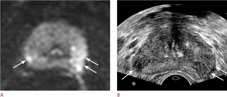 Fig. 12.