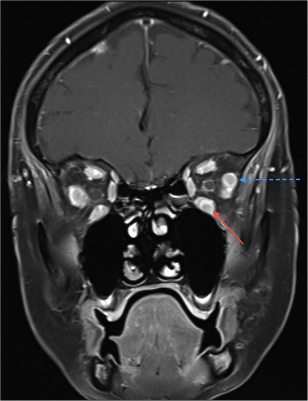 Figure 2