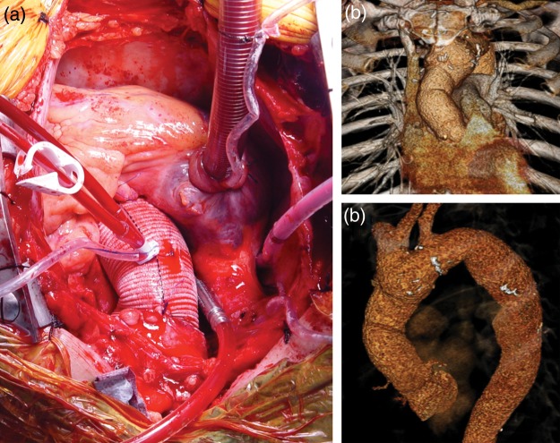 Figure 2: