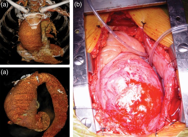 Figure 1: