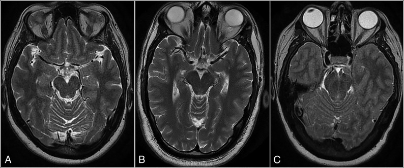 Fig 4.