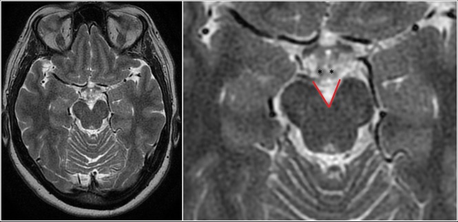 Fig 2.