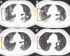 Fig 8