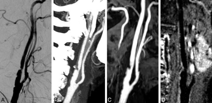 Fig 3.